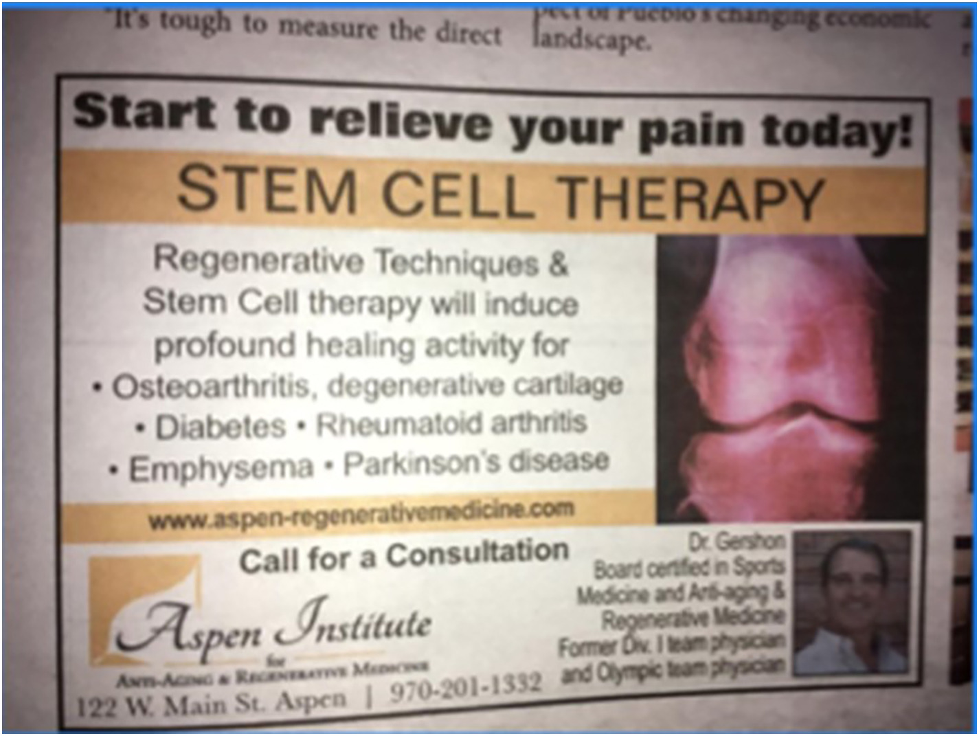 間充質(zhì)干細胞治療1型糖尿病臨床應(yīng)用案例 間充質(zhì)干細胞治療1型糖尿病臨床應(yīng)用案例