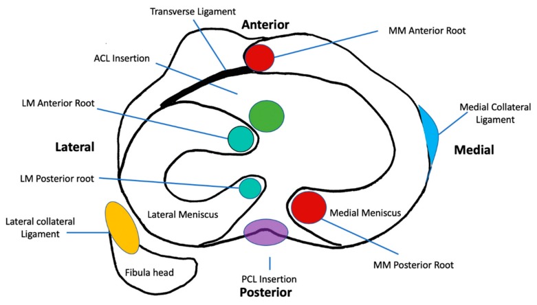 圖1：脛骨平臺水平的軸向截面示意圖，描繪了半月板的解剖結(jié)構(gòu)、附件和關(guān)系