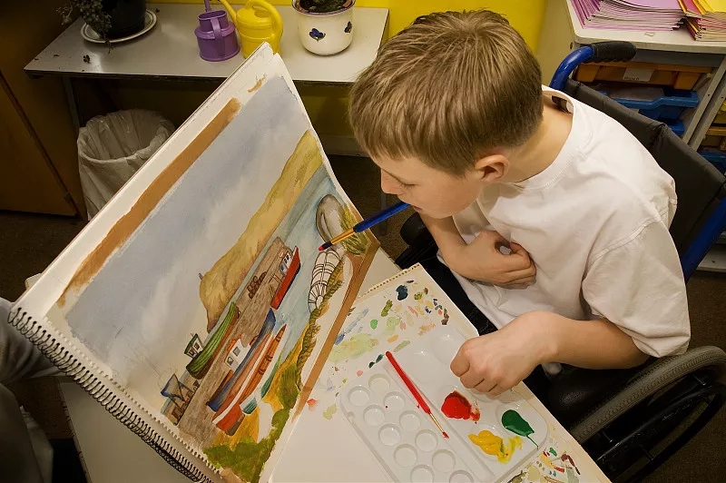 臨床表明:干細(xì)胞移植是一種很有前途的腦癱治療方法 臨床表明:干細(xì)胞移植是一種很有前途的腦癱治療方法