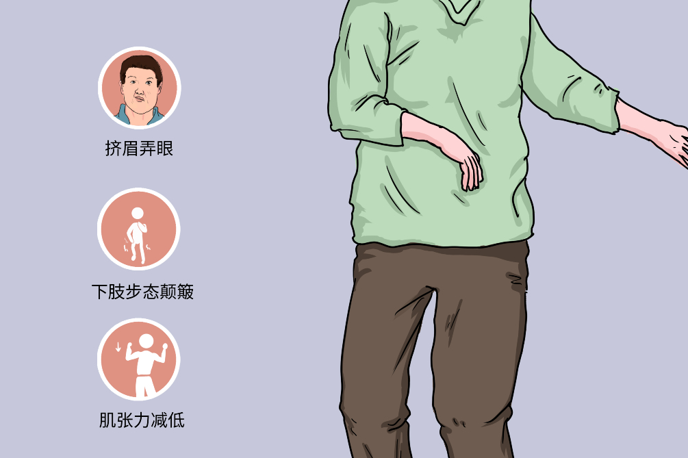 干細(xì)胞療法治療亨廷頓病的臨床前試驗進(jìn)展 干細(xì)胞療法治療亨廷頓病的臨床前試驗進(jìn)展