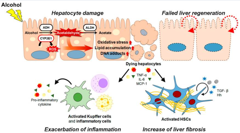 酒精及其代謝物通過各種途徑和/或機(jī)制共同促進(jìn)ALD的發(fā)病機(jī)制。（如圖1）