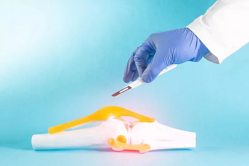 間充質(zhì)干細(xì)胞在人類半月板修復(fù)中的潛在用途:當(dāng)前見解