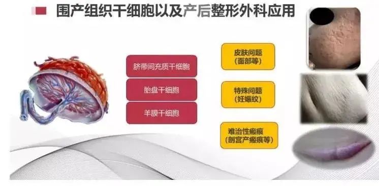 圍產(chǎn)組織細(xì)胞以及產(chǎn)后整形外科應(yīng)用