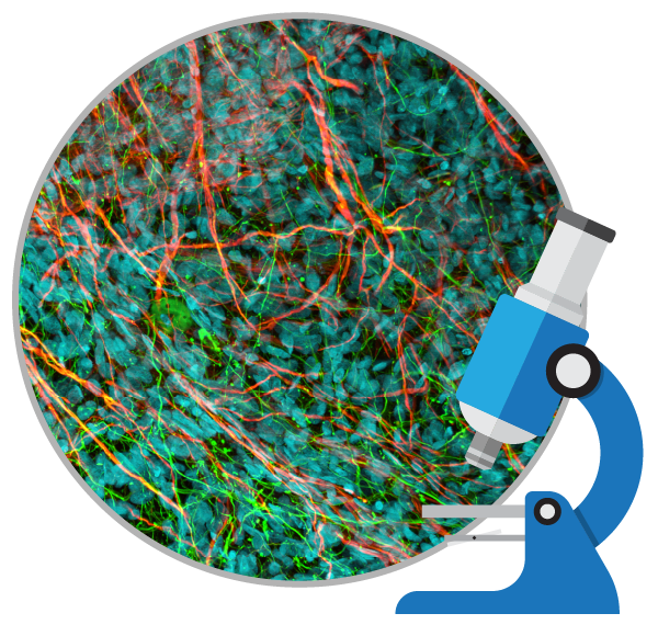 干細(xì)胞治療如何對自閉癥患者提供幫助？