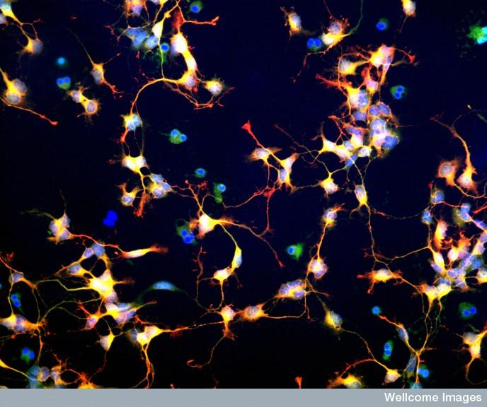 中科神經(jīng)干細胞 中科神經(jīng)干細胞