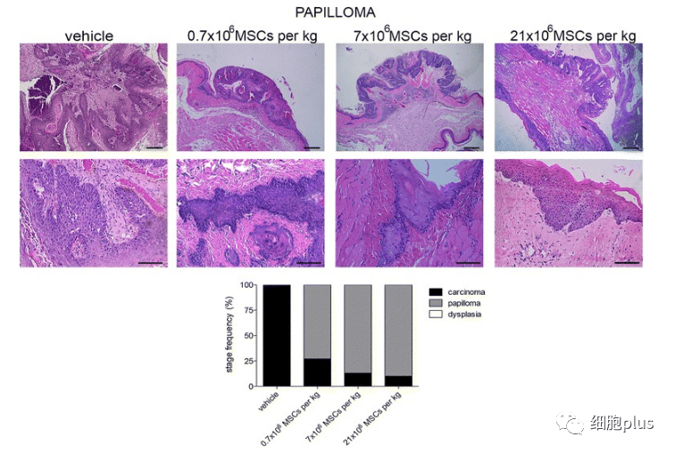 在非典型增生期，全身注射同種異體間充質干細胞不會增加腫瘤的惡性程度。