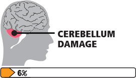 共濟失調性腦癱圖標