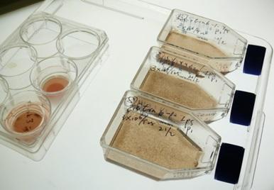 用生長因子培養(yǎng)的胚胎和誘導(dǎo)多能 (iPS) 干細胞變得有色素(棕色)并顯示出視網(wǎng)膜色素上皮細胞的特征