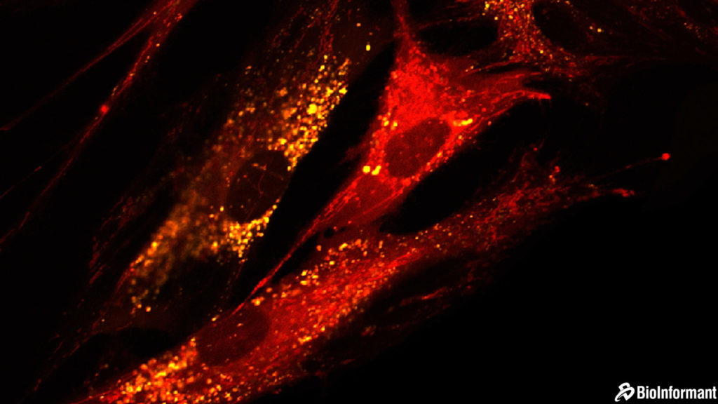 干細胞的好處| 間充質干細胞 (MSC) 相對于其他干細胞類型的優(yōu)勢 干細胞的好處| 間充質干細胞 (MSC) 相對于其他干細胞類型的優(yōu)勢