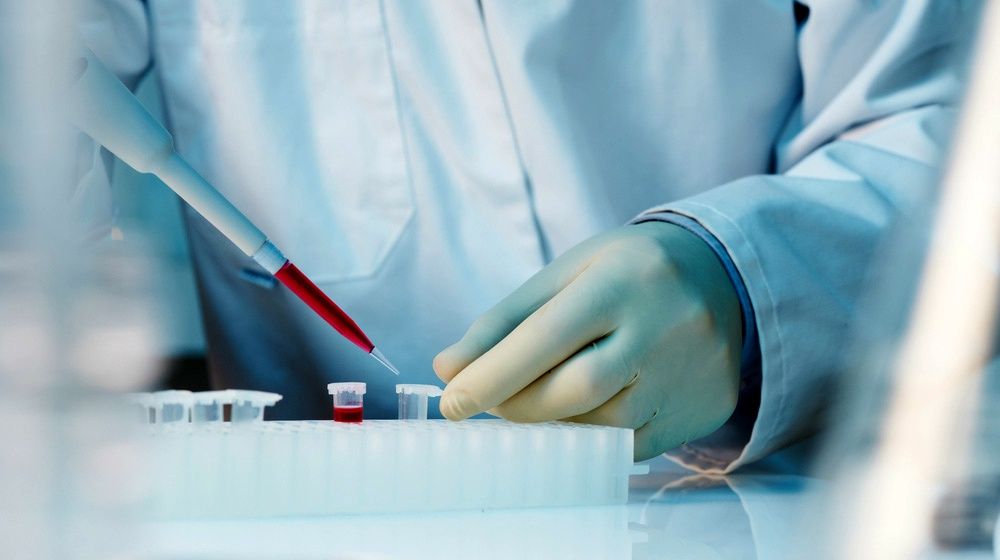 什么是干細(xì)胞移植-干細(xì)胞移植的流程和優(yōu)勢 什么是干細(xì)胞移植-干細(xì)胞移植的流程和優(yōu)勢