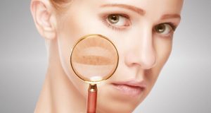 間充質干細胞治療系統(tǒng)性紅斑狼瘡 間充質干細胞治療系統(tǒng)性紅斑狼瘡