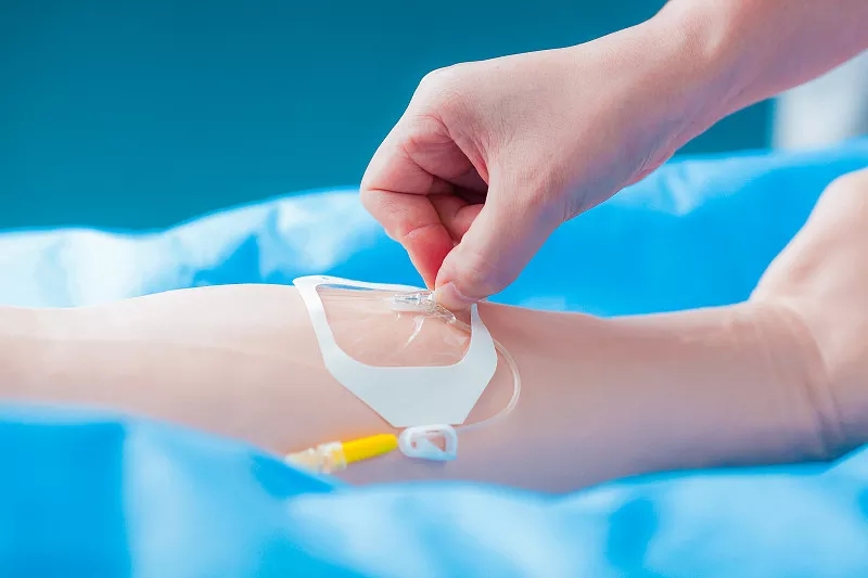 靜脈給藥 靜脈給藥