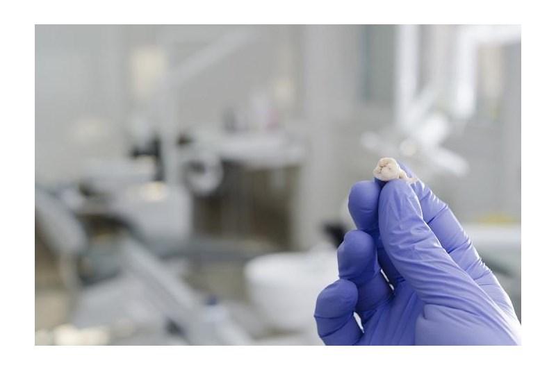 來自牙齒的干細(xì)胞可以幫助治療抑郁癥 來自牙齒的干細(xì)胞可以幫助治療抑郁癥