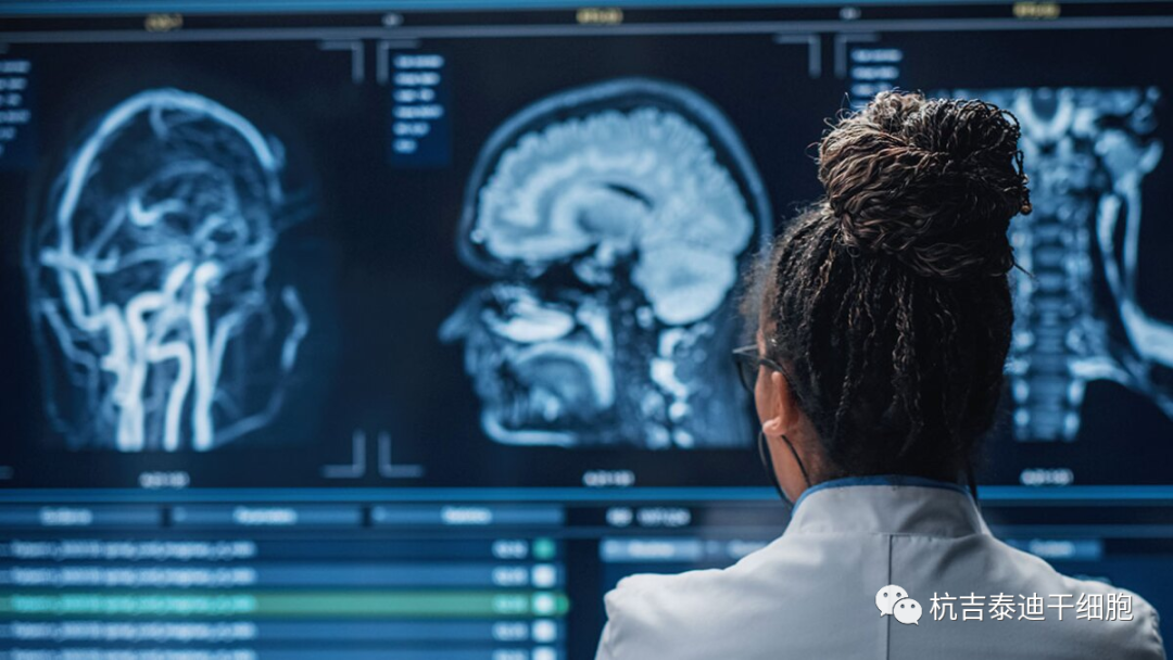 干細胞治療神經(jīng)退行性疾病臨床試驗研究進展