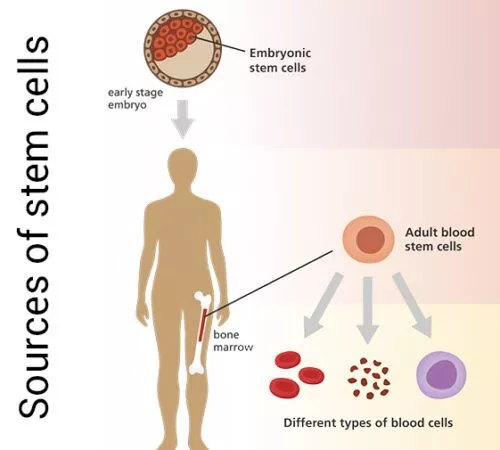 干細(xì)胞的來(lái)源是什么