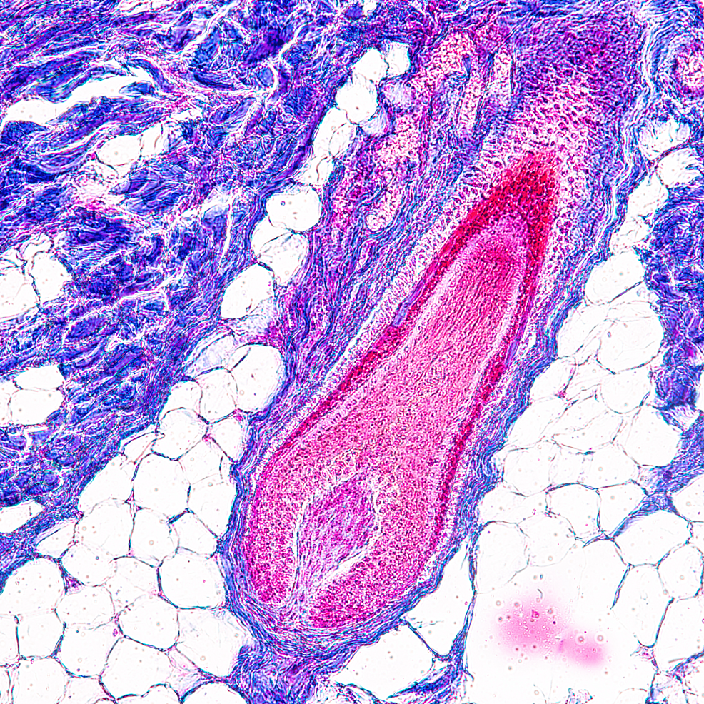 毛囊組織學(xué)觀察