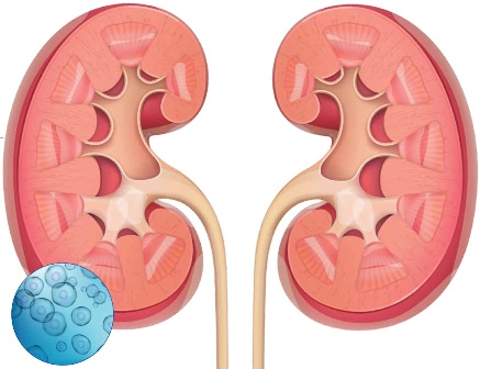 都有哪些干細(xì)胞類型應(yīng)用到腎臟疾病當(dāng)中？