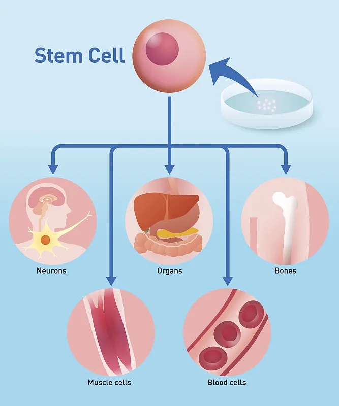 自體干細(xì)胞移植：工作原理、益處和風(fēng)險(xiǎn)