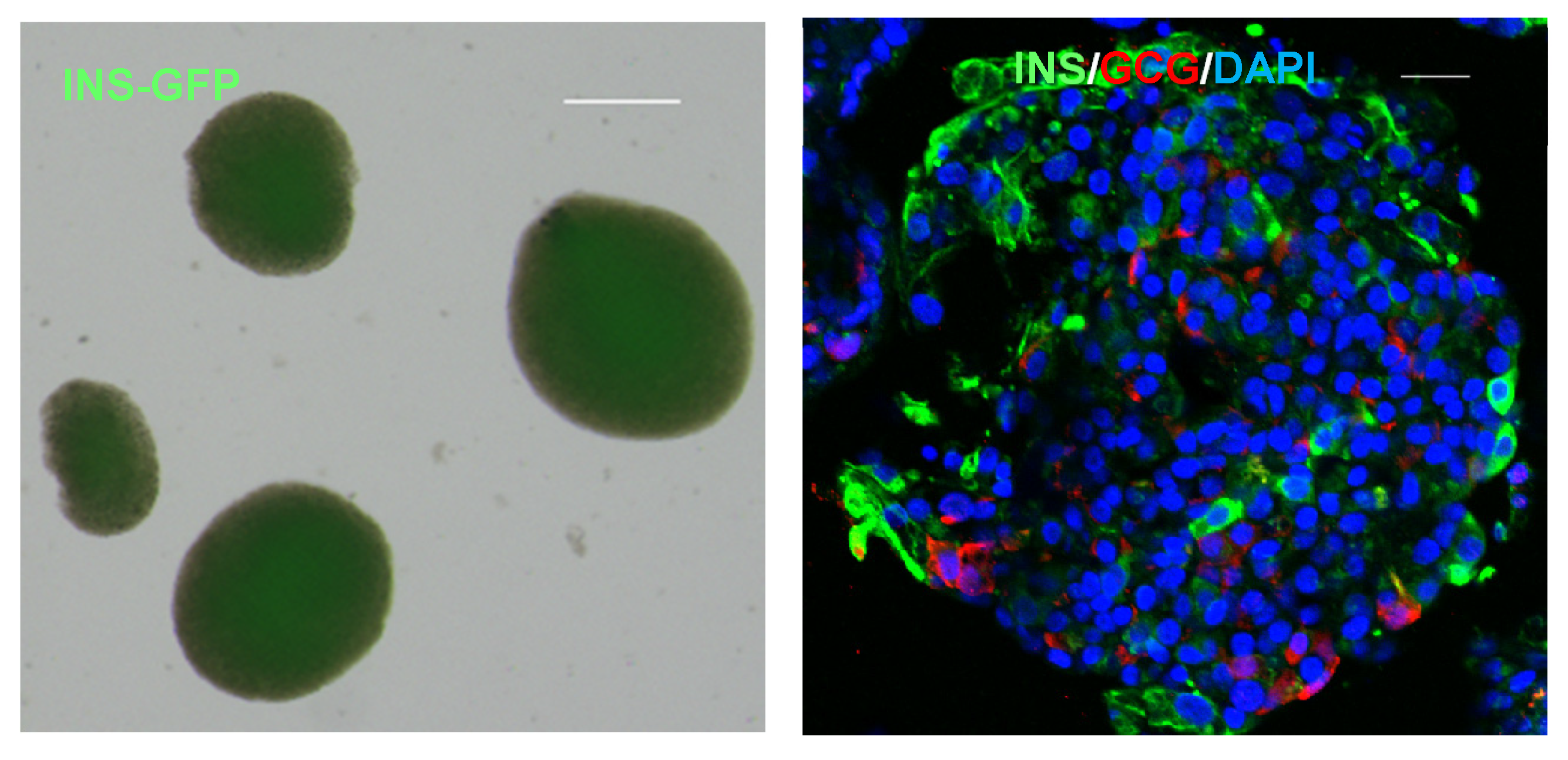 圖1顯示了人類多能干細(xì)胞 (hPSC) 衍生的胰島器官的圖像 圖1顯示了人類多能干細(xì)胞 (hPSC) 衍生的胰島器官的圖像