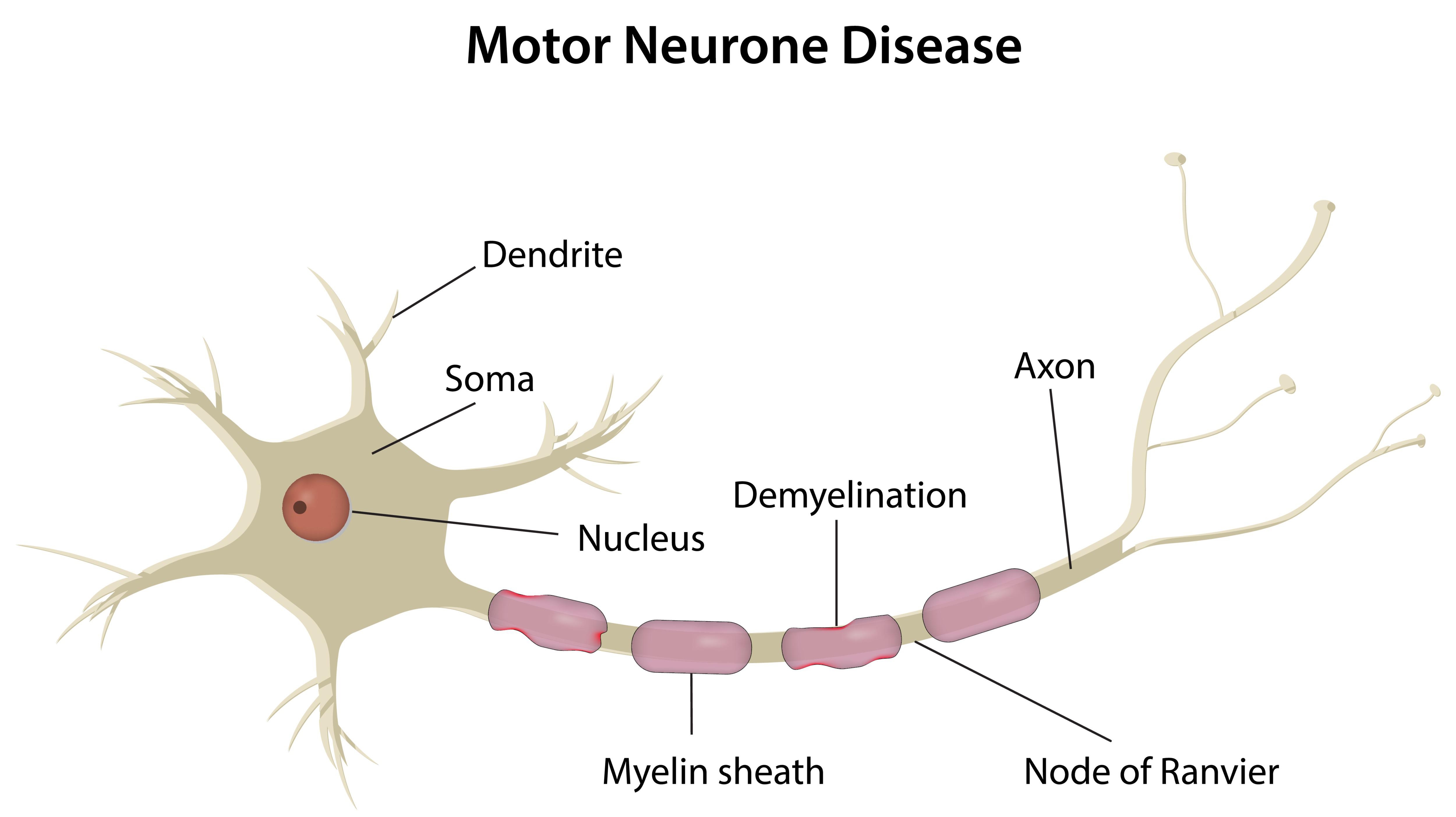 什么是運(yùn)動(dòng)神經(jīng)元??？