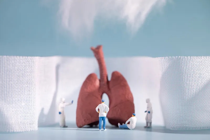 慢性阻塞性肺?。–OPD）的四個(gè)階段