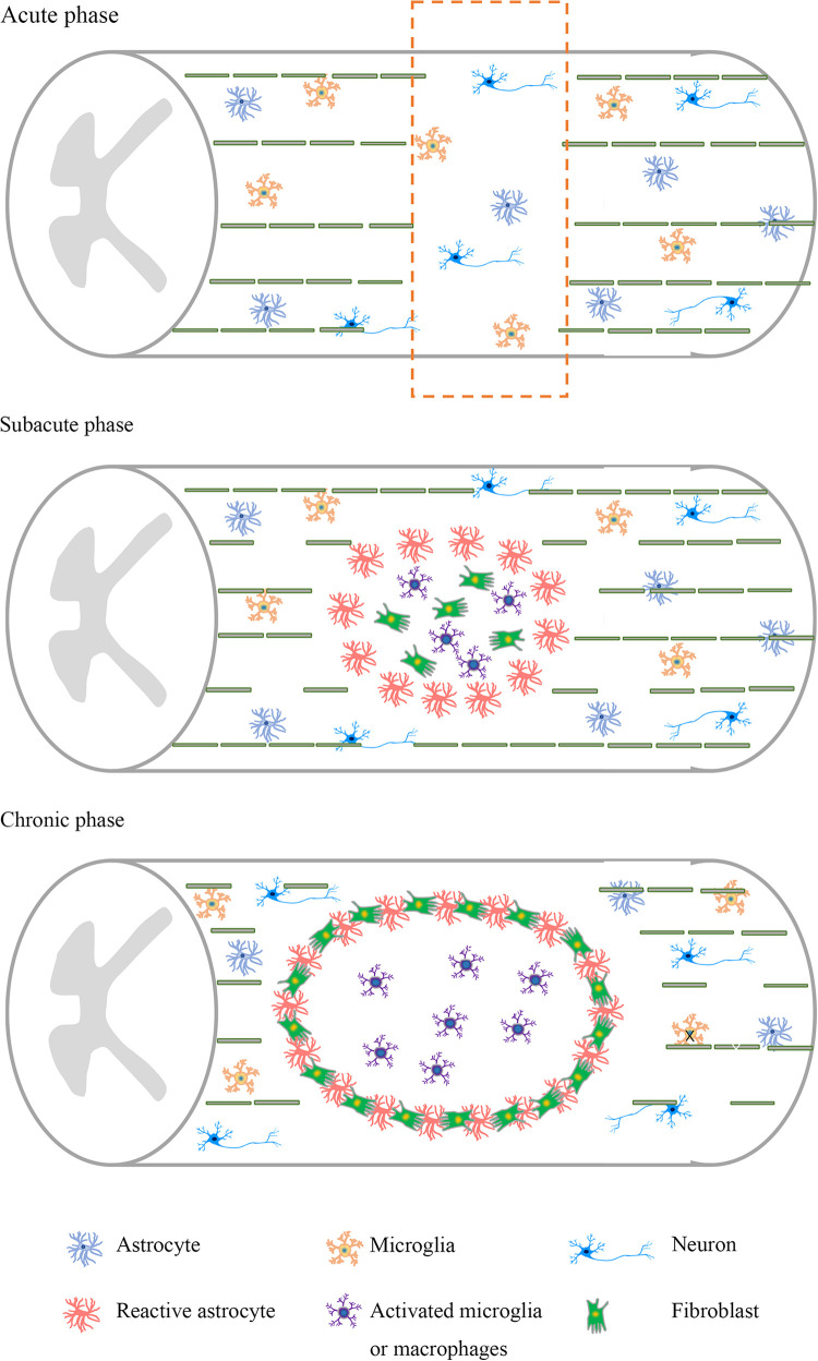 圖1：脊髓損傷不同階段的病理特點。