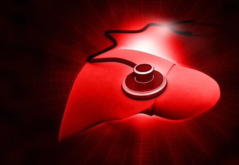 肝硬化的早期癥狀 肝硬化的早期癥狀