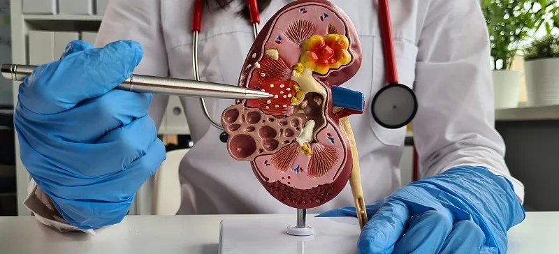 狼瘡的治療方法有哪些？