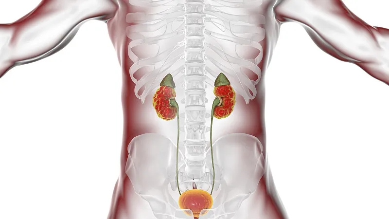 間充質(zhì)干細(xì)胞治療狼瘡性腎炎的臨床研究進展