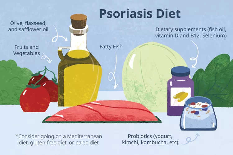 適合銀屑病患者吃的5種食物，你知道幾種？