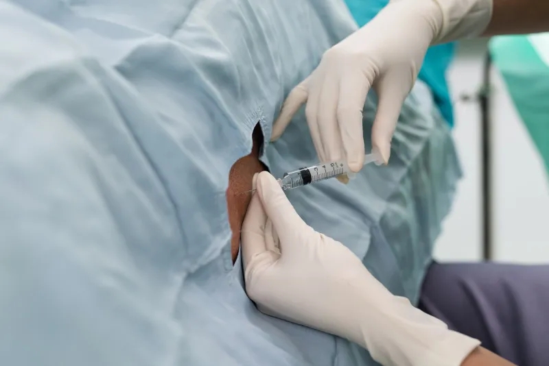 干細(xì)胞，-鞘內(nèi)給藥，-神經(jīng)系統(tǒng)疾病