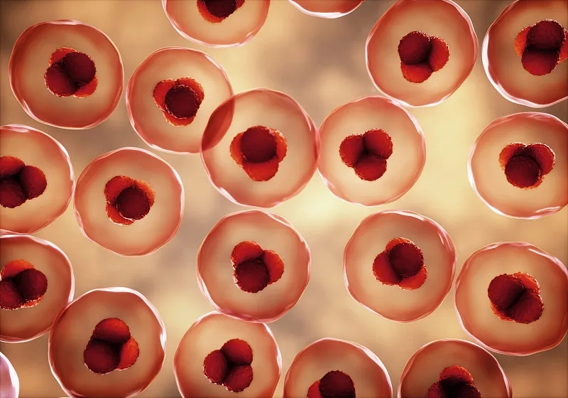 第一位接受Gamida Cell擴(kuò)展臍帶血細(xì)胞療法 Omisirge?治療的患者 第一位接受Gamida Cell擴(kuò)展臍帶血細(xì)胞療法 Omisirge?治療的患者