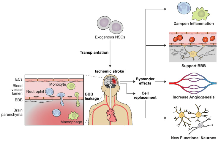 神經(jīng)干細胞移植治療缺血性腦卒中的作用機制 神經(jīng)干細胞移植治療缺血性腦卒中的作用機制