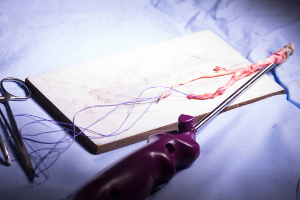 臍帶血干細胞移植:分析與研究 (2023) 臍帶血干細胞移植:分析與研究 (2023)