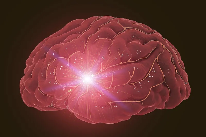 神經(jīng)干細胞移植治療缺血性卒中的作用 神經(jīng)干細胞移植治療缺血性卒中的作用