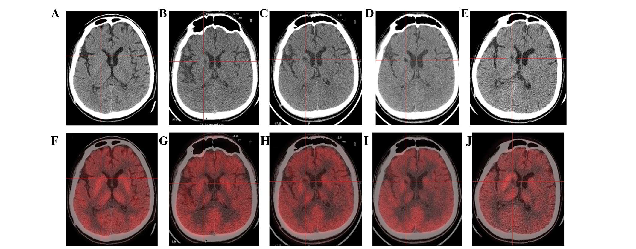 圖1：計算機斷層掃描 (CT) 和正電子發(fā)射斷層掃描 (PET) 掃描。