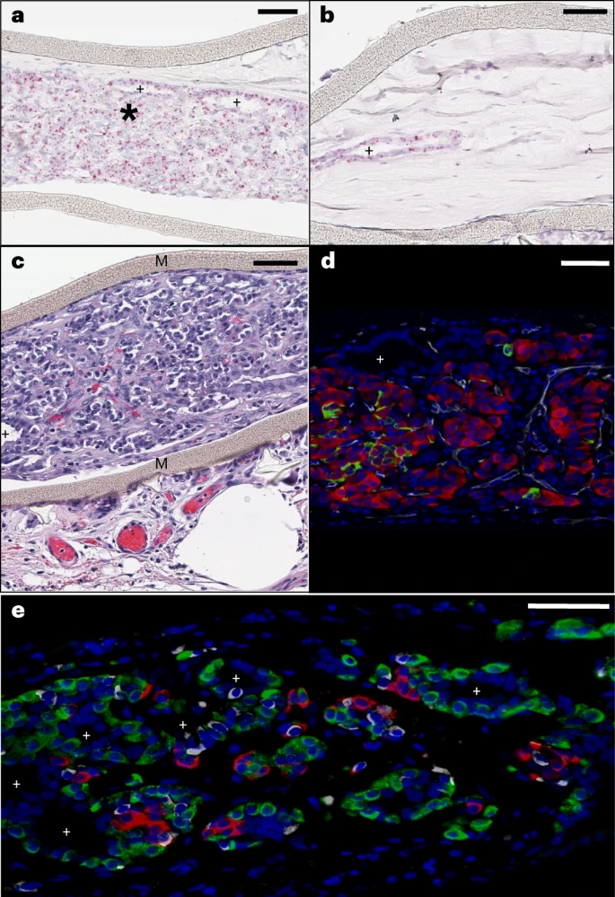 圖3：植入后第6個(gè)月時(shí)裝置封裝的人類干細(xì)胞衍生植入物的成分。