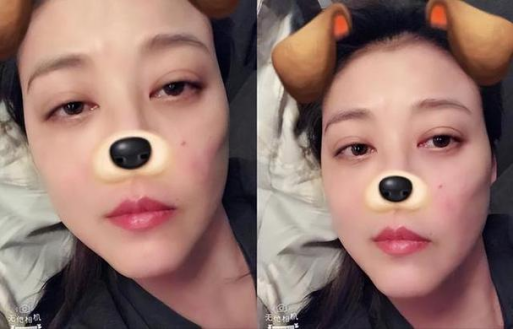 △ 周海媚之前發(fā)布的自拍照中也隱約可見面部紅斑