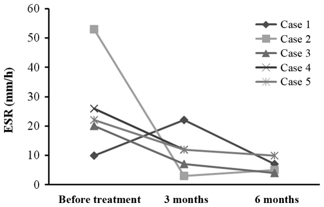 圖3:每位患者在治療前后的ESR。3例患者血沉明顯下降