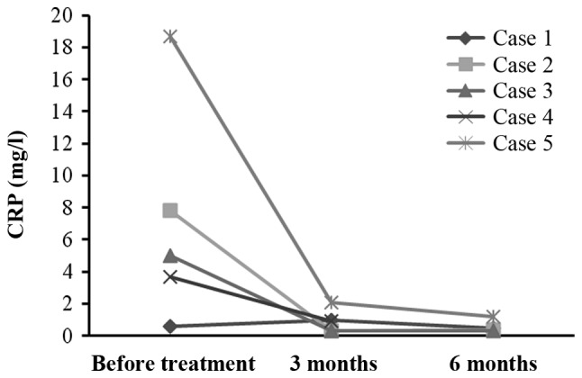 圖4：每位患者治療前后的CRP水平。1名患者的CRP水平降低，而其他4名患者的CRP水平保持穩(wěn)定并在正常范圍內(nèi)。