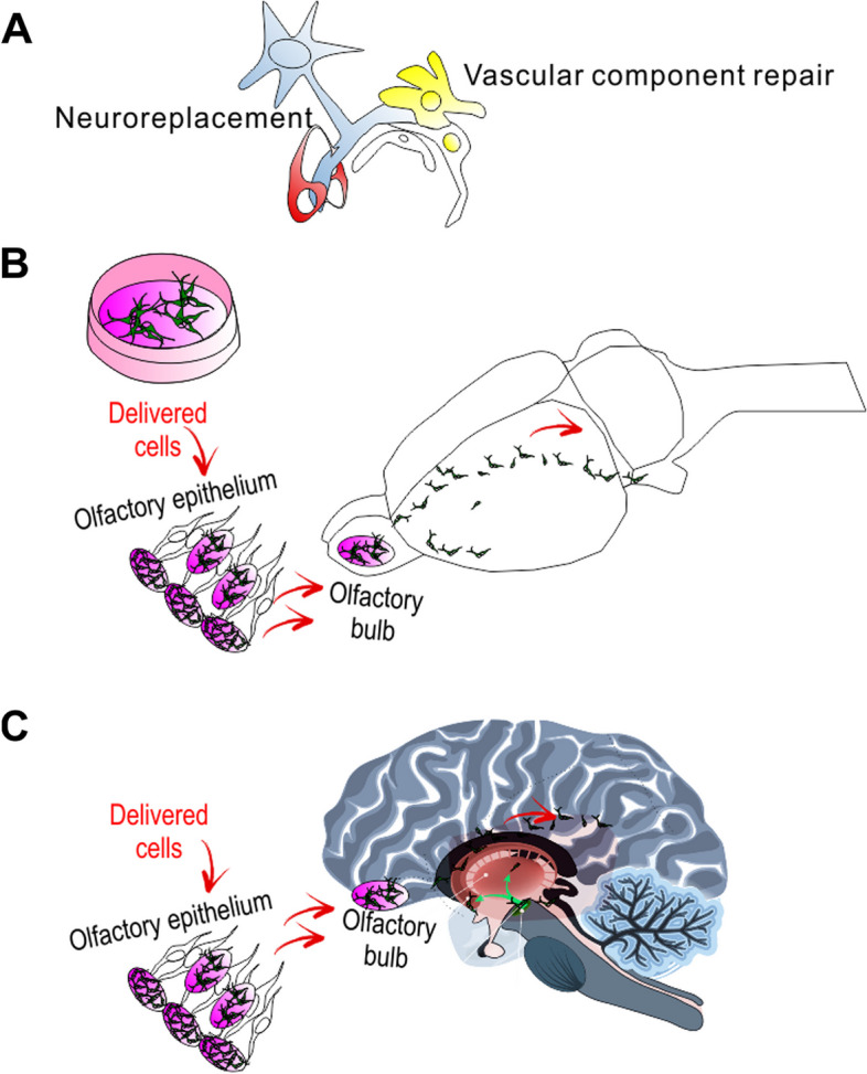圖1：干細(xì)胞移植治療帕金森病的示意圖。