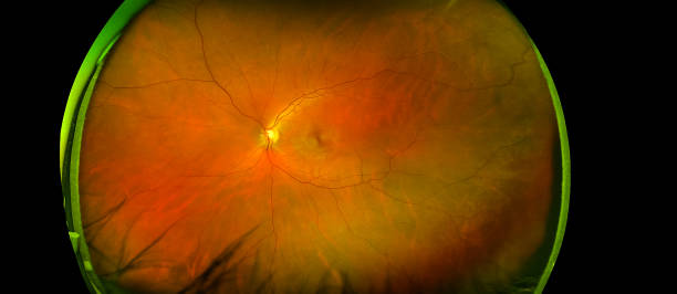 北大人民醫(yī)院眼科研究所:干細(xì)胞治療遺傳性視網(wǎng)膜疾病研究看點(diǎn) 北大人民醫(yī)院眼科研究所:干細(xì)胞治療遺傳性視網(wǎng)膜疾病研究看點(diǎn)