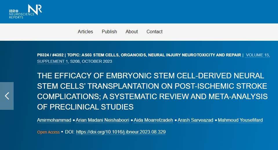 胚胎干細胞衍生的神經(jīng)干細胞移植對缺血性中風后并發(fā)癥的功效如何？