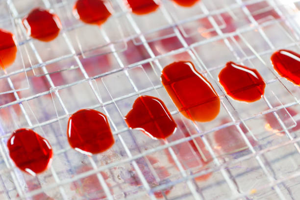 可以用臍帶血干細(xì)胞可以治療哪些疾??？