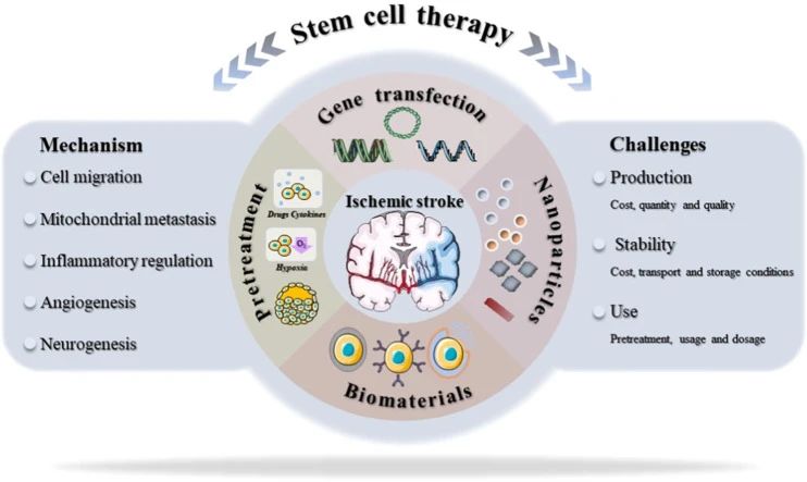 干細(xì)胞治療中風(fēng)新進(jìn)展：一項(xiàng)206人的隨機(jī)臨床試驗(yàn)結(jié)果揭曉啦！