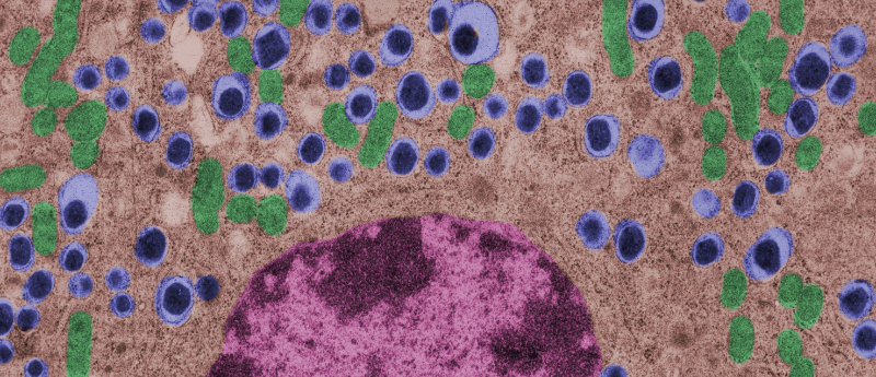 利用間充質(zhì)干細胞治療1型糖尿病的潛力如何？