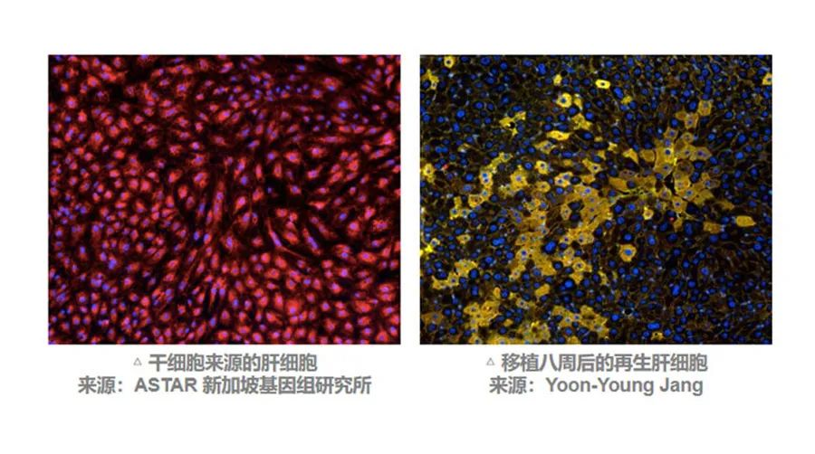 MSC有望通過不同途徑調(diào)動肝臟細胞再生來改善預(yù)后。