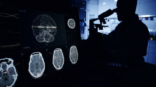 神經(jīng)系統(tǒng)疾病發(fā)病機制復雜，涉及基因突變、衰老過程等多種因素。