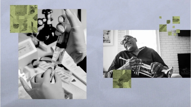 干細(xì)胞療法能治療帕金森病嗎？