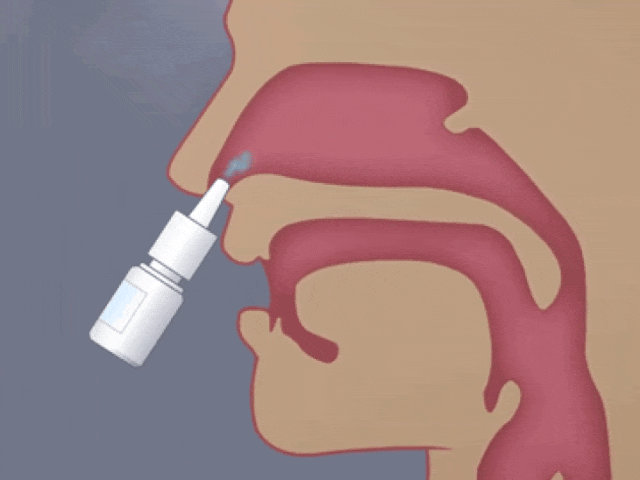 日本居家干細(xì)胞噴鼻能治療腦梗死：是科學(xué)突破還是商業(yè)噱頭？